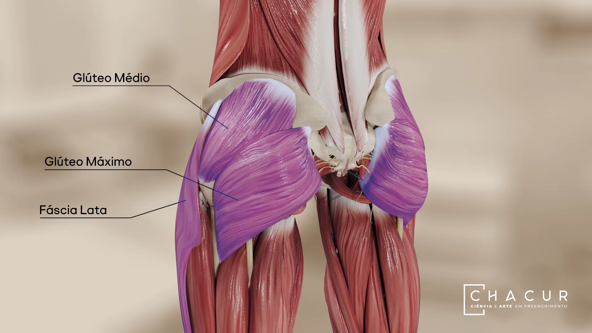 Representação anatômica da região glútea destacando os músculos glúteo médio, glúteo máximo e fáscia lata